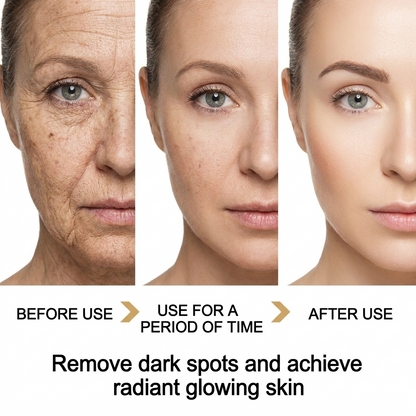 Before and after results using PeelRevive Turmeric Dark Spot Correcting Oil Serum