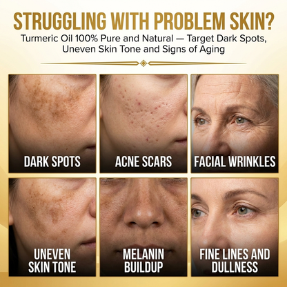 Skin problems targeted by PeelRevive Turmeric Serum — dark spots, uneven tone, dullness